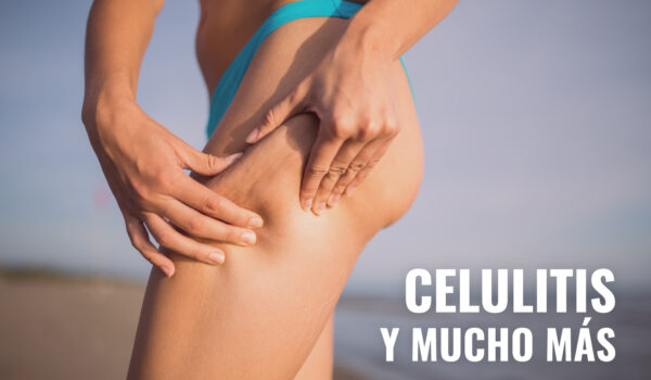 5 TRUCOS PARA SEGUIR REDUCIENDO LA CELULITIS EN VERANO