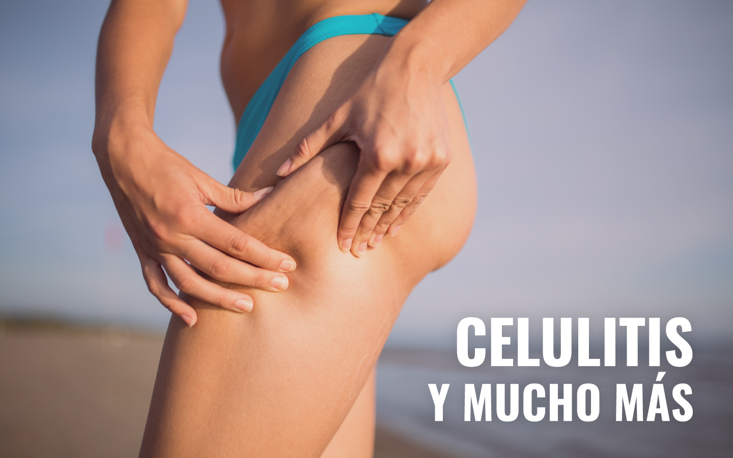 En este momento estás viendo 5 TRUCOS PARA SEGUIR REDUCIENDO LA CELULITIS EN VERANO