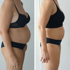 Resultado de una amazona de 45 años en perimenopausia