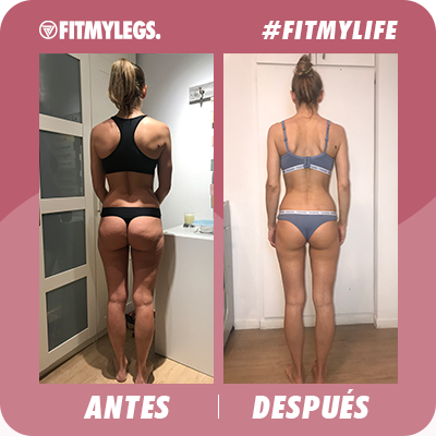 Plantilla-Carrusel-Antes-y-despues-4- (1)