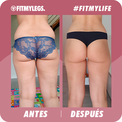 Plantilla-Carrusel-Antes-y-despues-9-